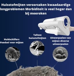 Mijtenzuiger - Handstofzuiger Draadloos - Kruimeldief Snoerloos - Mini Stofzuiger - Kleine Stofzuiger - UV Bank / Bed Reiniger — thumbnail 5